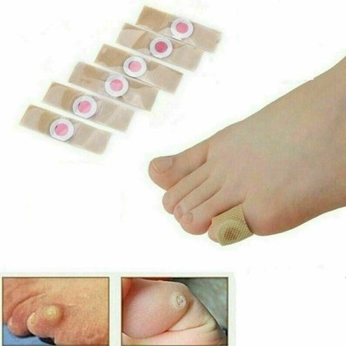 6Pcs Box Foot Corn Removal  Plaster with  Warts Thorn Patch Soften Skin Sticker