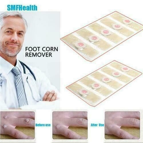 6Pcs Box Foot Corn Removal  Plaster with  Warts Thorn Patch Soften Skin Sticker