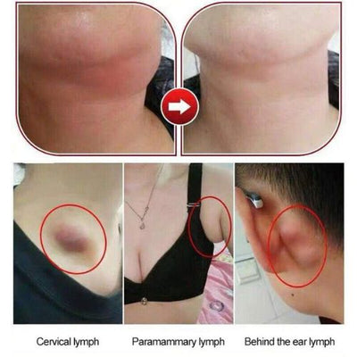 Lymphatic Care Herbal Detox Patch Underarm Neck Waist Thigh Lymph Remove Fat CA