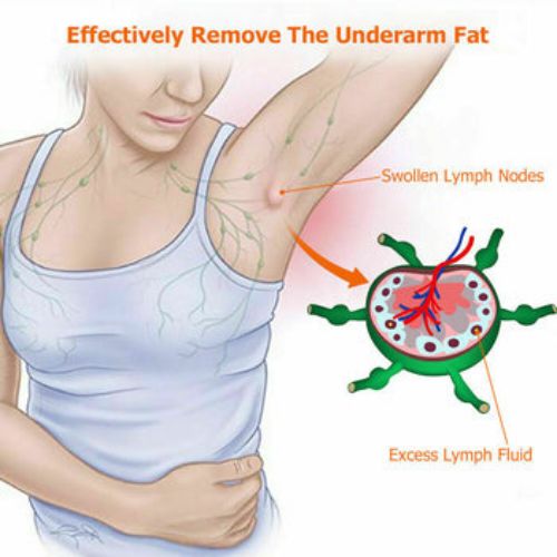 Lymphatic Care Herbal Detox Patch Underarm Neck Waist Thigh Lymph Remove Fat CA